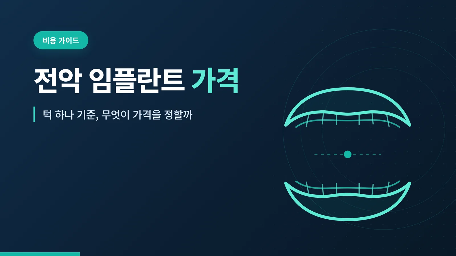 전악 임플란트 가격 관련 이미지